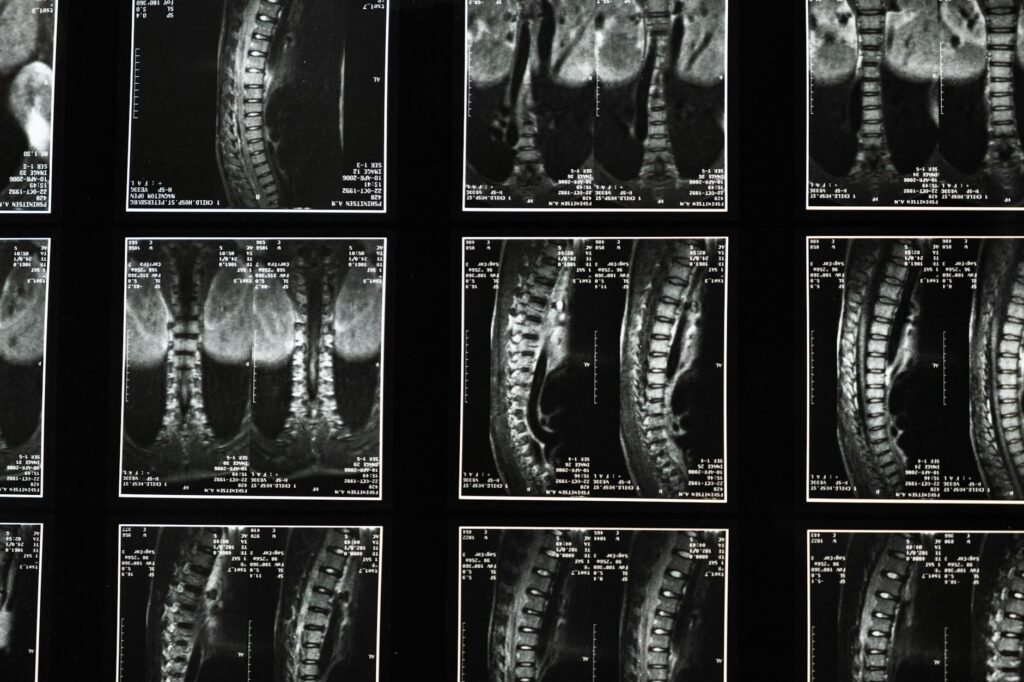 Image showing a breakdown of medical bills related to an injury claim — medical bills injury claim