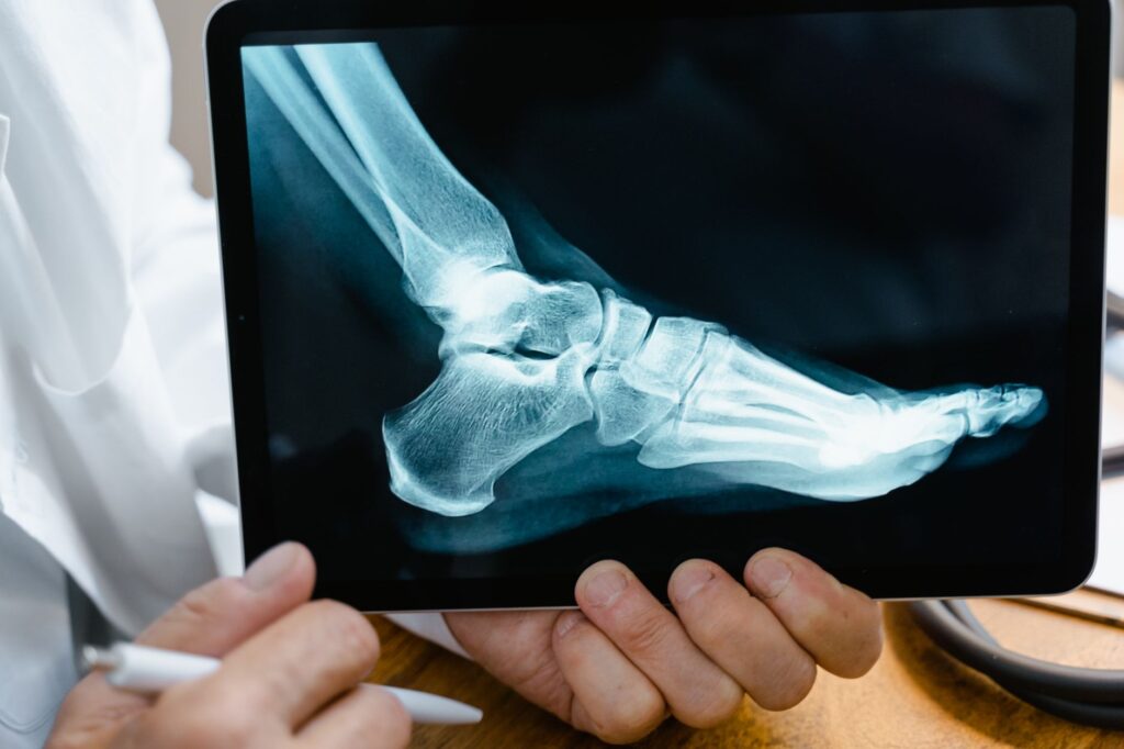 An image depicting a person reviewing medical expenses related to their injury. — mistakes injury claim calculator