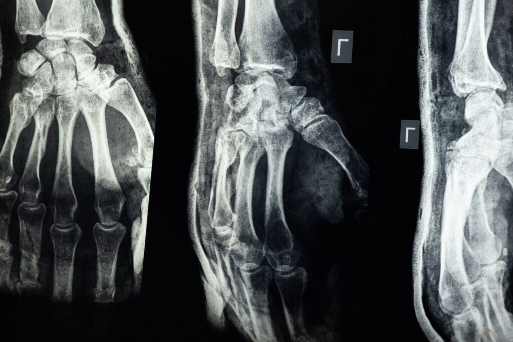 An image showing common types of injuries considered in claims. — Injury Claim Calculator