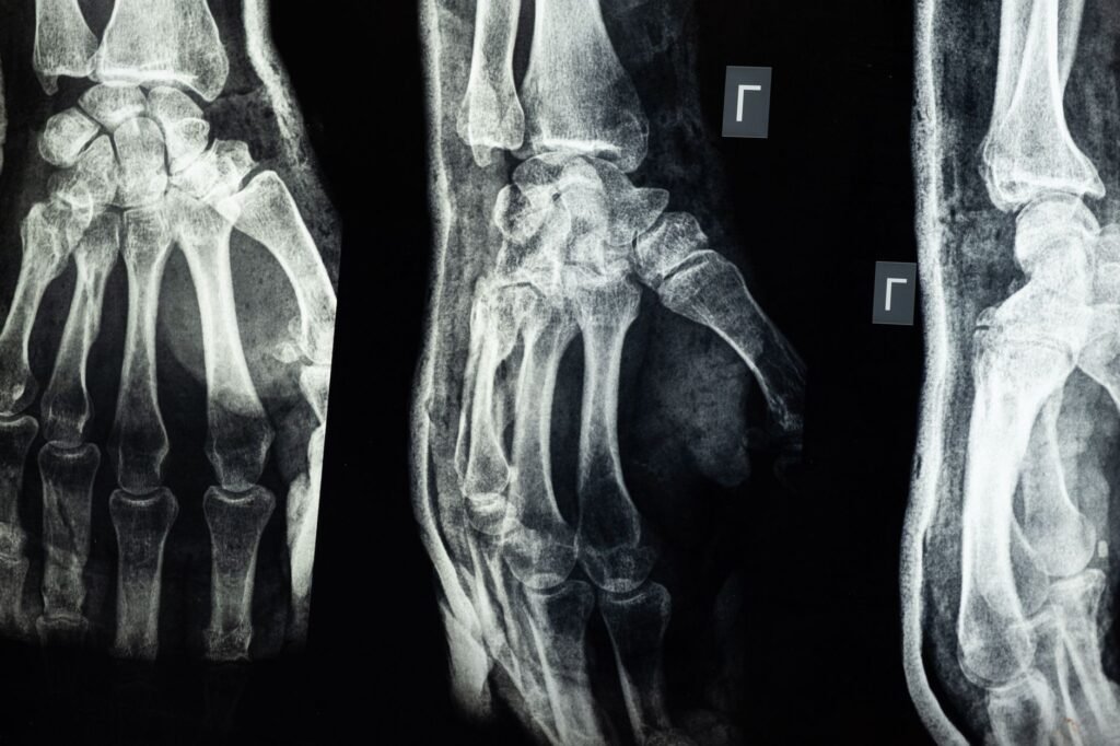 A case study snapshot showing real examples of types of injuries claim values.