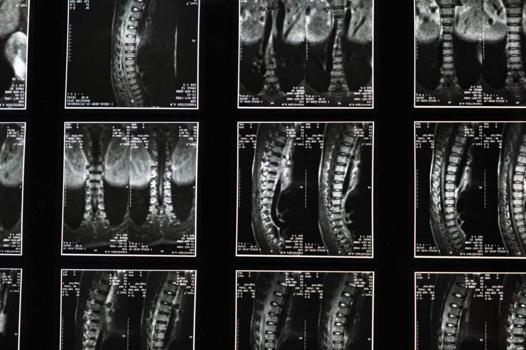 Image of medical records illustrating their importance in claims related to factors affecting injury claim settlement.